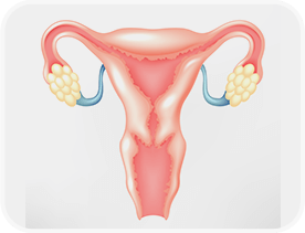 Cáncer Ginecológico de Cervix